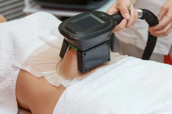 Image of person having fat freezing treatment to help weight gain Frimley