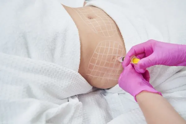 image of fat dissolving injections on love handles to help combat weight gain Frimley