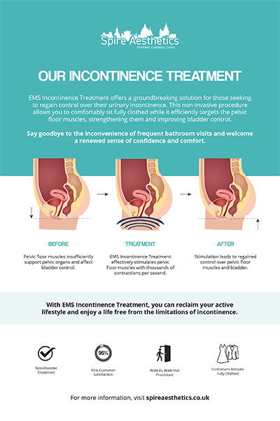 image to show how EMS treatment works for female urinary incontinence Frimley