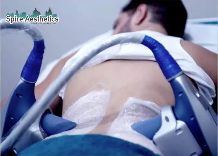 Man having fat freezing treatment done on love handles before a competitions Frimley to create a sculpted look.