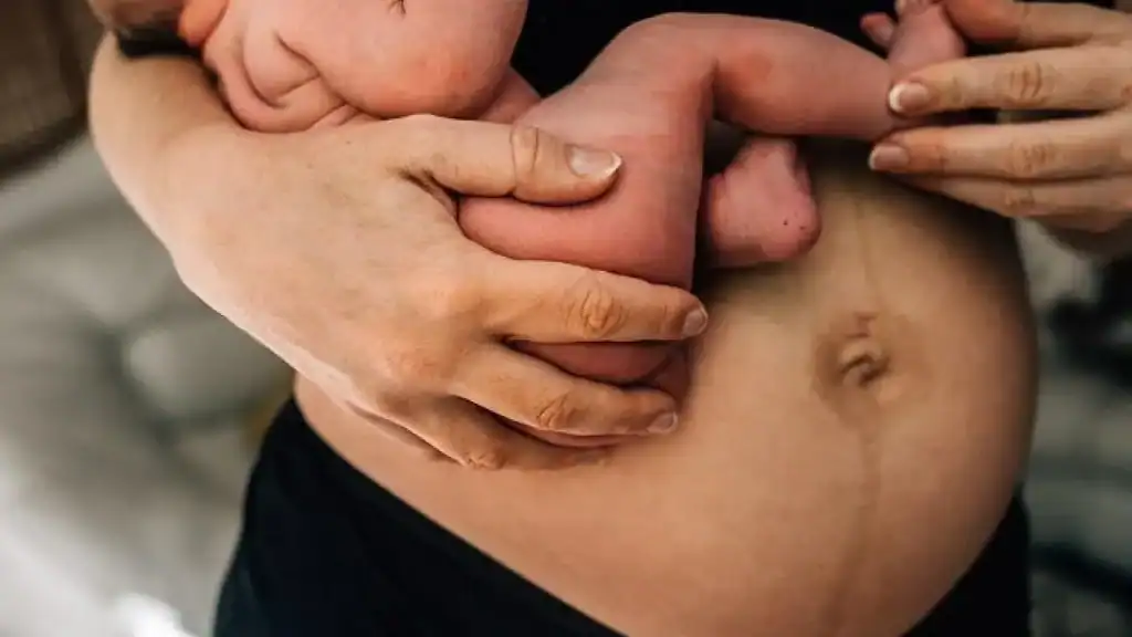 Why Is My Stomach Still Big After Pregnancy Frimley?